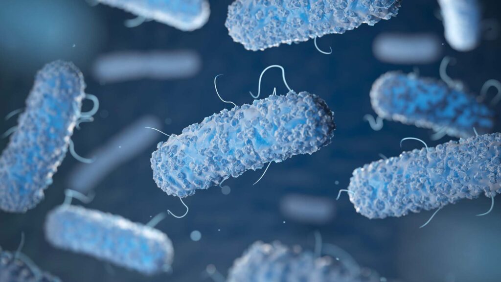 Trattamento e prevenzione anti legionella
